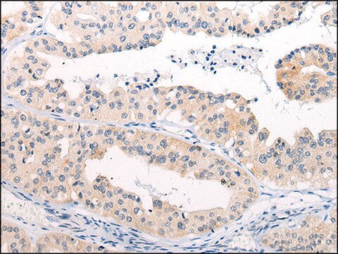 Anti-ANAPC15 affinity isolated antibody