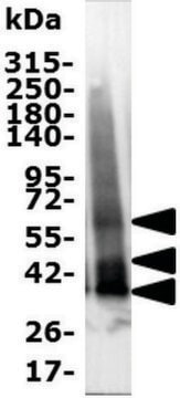 MT1 (receptor melatoniny 1)