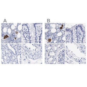 Anti-TREML1 antibody produced in rabbit Prestige Antibodies&#174; Powered by Atlas Antibodies, affinity isolated antibody, buffered aqueous glycerol solution