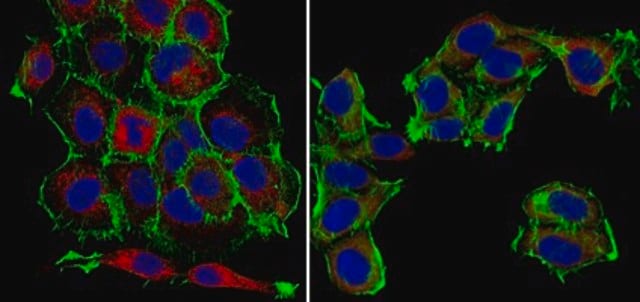 Anti-S100A4 Antibody, clone 9D5.1 clone 9D5.1, from mouse