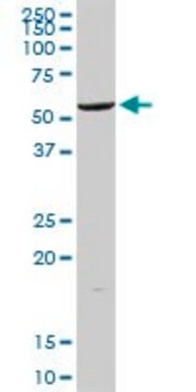 ALDH2 antibody Western, ELISA SAB1410363 ALDM