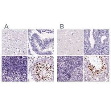 Anti-SPESP1 antibody produced in rabbit Prestige Antibodies&#174; Powered by Atlas Antibodies, affinity isolated antibody, buffered aqueous glycerol solution