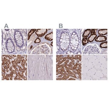 Anti-GLYAT antibody produced in rabbit Prestige Antibodies&#174; Powered by Atlas Antibodies, affinity isolated antibody