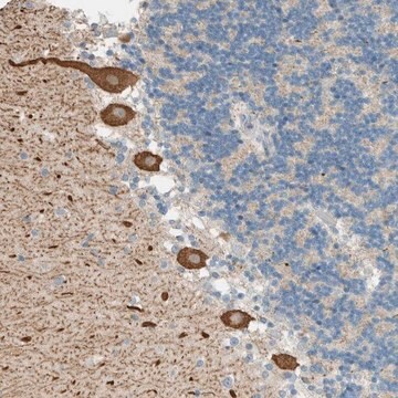 Anti-PTGES3L-AARSD1 antibody produced in rabbit Prestige Antibodies&#174; Powered by Atlas Antibodies, affinity isolated antibody, buffered aqueous glycerol solution, Ab1