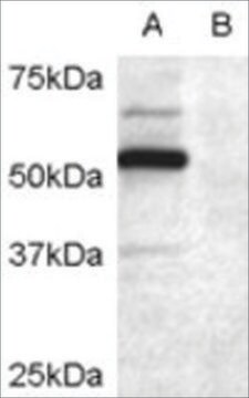 抗DCDC2抗体 ヤギ宿主抗体 affinity isolated antibody, buffered aqueous solution