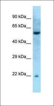 Anti-RAB27A antibody produced in rabbit affinity isolated antibody