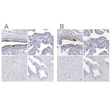 Anti-CCDC181 antibody produced in rabbit Prestige Antibodies&#174; Powered by Atlas Antibodies, affinity isolated antibody, buffered aqueous glycerol solution, ab1