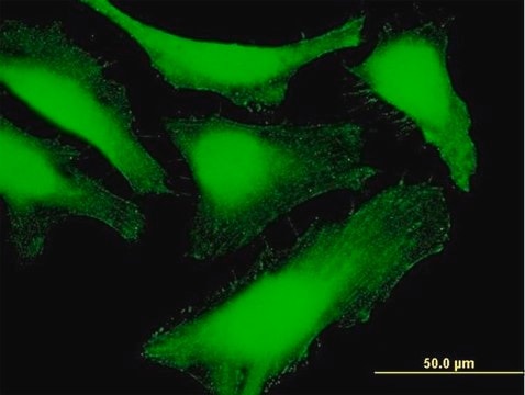 Anti-SDCBP antibody produced in mouse purified immunoglobulin, buffered aqueous solution