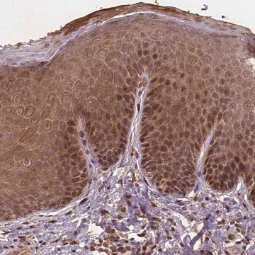 Anti-NIPAL2 antibody produced in rabbit Prestige Antibodies&#174; Powered by Atlas Antibodies, affinity isolated antibody, buffered aqueous glycerol solution