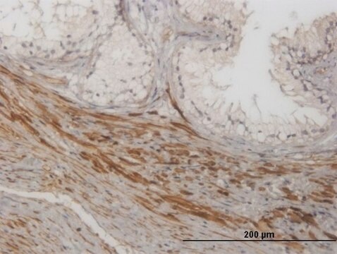 Monoclonal Anti-NKIRAS1 antibody produced in mouse clone 2A7, purified immunoglobulin, buffered aqueous solution