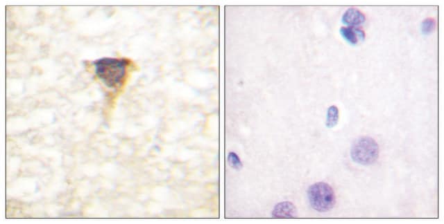 Anti-CAMK4 antibody produced in rabbit affinity isolated antibody