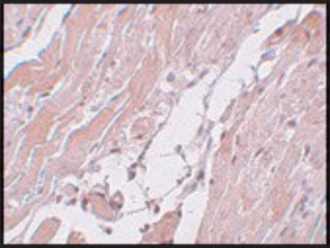 Anti-CCDC47 antibody produced in rabbit affinity isolated antibody