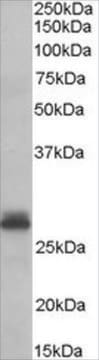 Anti-Tafazzin antibody produced in goat affinity isolated antibody, buffered aqueous solution