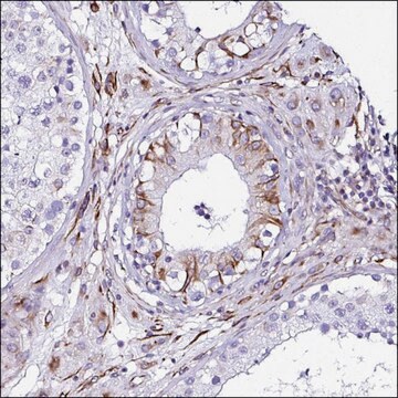 Anti-DEPDC5 antibody produced in rabbit Prestige Antibodies&#174; Powered by Atlas Antibodies, affinity isolated antibody, buffered aqueous glycerol solution