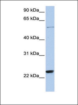 Anti-ZNF83 antibody produced in rabbit affinity isolated antibody