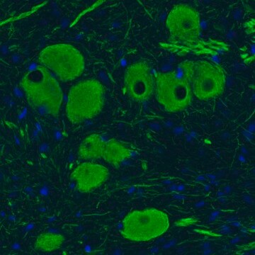 Monoclonal Anti-NEFM antibody produced in mouse Prestige Antibodies&#174; Powered by Atlas Antibodies, clone CL2678, purified immunoglobulin, buffered aqueous glycerol solution