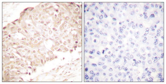 Anti-SENP1 antibody produced in rabbit affinity isolated antibody