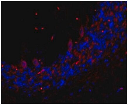 Anti-TMEM106B-Antikörper, Klon&nbsp;TME-N&nbsp;6F2 clone TME-N 6F2, from rat