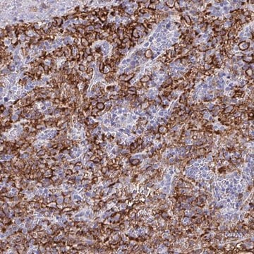 Anti-FCGR3A antibody produced in rabbit Prestige Antibodies&#174; Powered by Atlas Antibodies, affinity isolated antibody, buffered aqueous glycerol solution