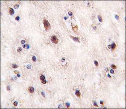 Anti-MEKK3 (center) antibody produced in rabbit Ig fraction of antiserum, buffered aqueous solution