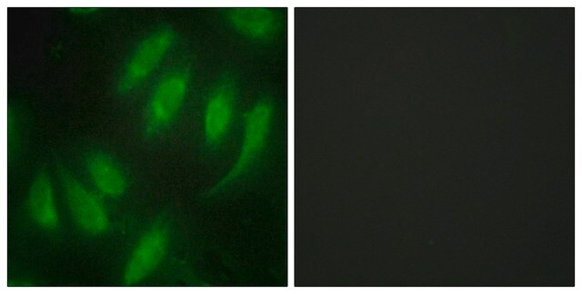 Anti-HEXIM1 antibody produced in rabbit affinity isolated antibody