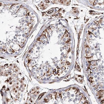 Anti-ALG1L antibody produced in rabbit Prestige Antibodies&#174; Powered by Atlas Antibodies, affinity isolated antibody, buffered aqueous glycerol solution