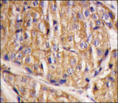 Anti-RAB23 (C-term) antibody produced in rabbit Ig fraction of antiserum, buffered aqueous solution