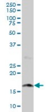 Anti-NUDT2 antibody produced in mouse purified immunoglobulin, buffered aqueous solution