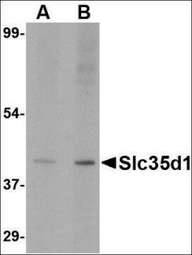 Anti-Slc35D1 (ab2) antibody produced in rabbit affinity isolated antibody, buffered aqueous solution