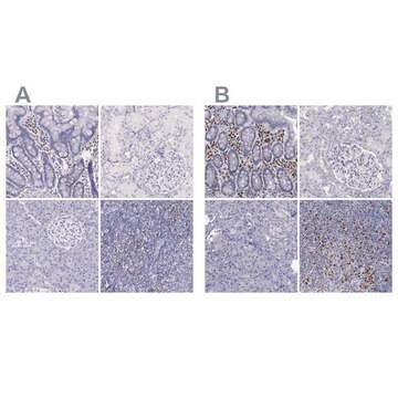 Anti-IRF4 antibody produced in rabbit Prestige Antibodies&#174; Powered by Atlas Antibodies, affinity isolated antibody, buffered aqueous glycerol solution