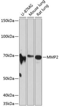 Anti- MMP2 antibody produced in rabbit