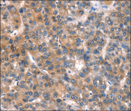 Anti-CACNA1A antibody produced in rabbit affinity isolated antibody