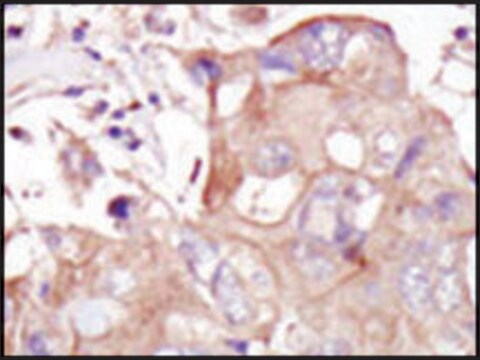 Anti-GLK (C-term) antibody produced in rabbit IgG fraction of antiserum, buffered aqueous solution