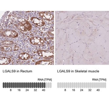 Anti-LGALS9 antibody produced in rabbit Prestige Antibodies&#174; Powered by Atlas Antibodies, affinity isolated antibody, buffered aqueous glycerol solution