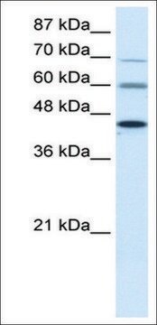 Anti-PRMT3 antibody produced in rabbit affinity isolated antibody