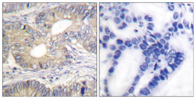 Anti-Somatostatin antibody produced in rabbit affinity isolated antibody