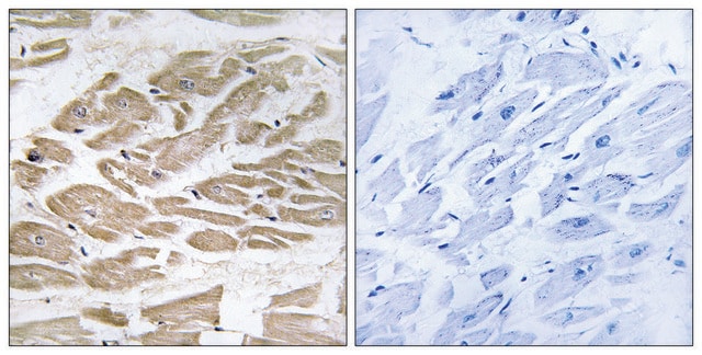 Anti-BRP44L antibody produced in rabbit affinity isolated antibody