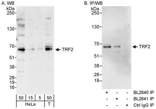 Rabbit anti-TRF2 Antibody, Affinity Purified Powered by Bethyl Laboratories, Inc.