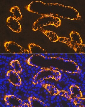 Anti-PDZK1 Antibody, clone 5C1D3, Rabbit Monoclonal