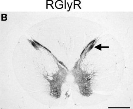 Anti-Glycine Receptor Antibody Chemicon&#174;, from rabbit