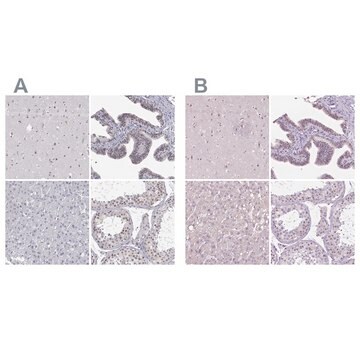 Anti-NHP2 antibody produced in rabbit Prestige Antibodies&#174; Powered by Atlas Antibodies, affinity isolated antibody, buffered aqueous glycerol solution