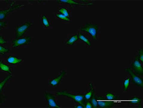 Anti-PFKFB1 antibody produced in rabbit purified immunoglobulin, buffered aqueous solution