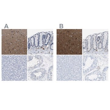 Anti-MAPRE2 antibody produced in rabbit Prestige Antibodies&#174; Powered by Atlas Antibodies, affinity isolated antibody, buffered aqueous glycerol solution