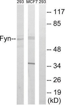 Anti-FYN antibody produced in rabbit affinity isolated antibody