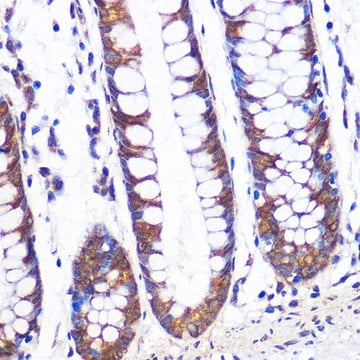 Anti-TCP1 alpha Antibody, clone 3G9G8, Rabbit Monoclonal