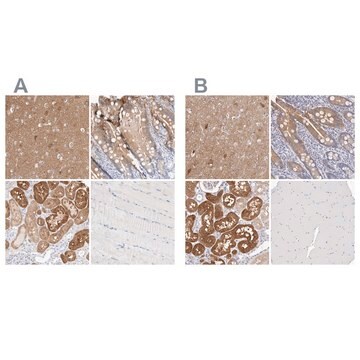 Anti-GDA antibody produced in rabbit Prestige Antibodies&#174; Powered by Atlas Antibodies, affinity isolated antibody, buffered aqueous glycerol solution