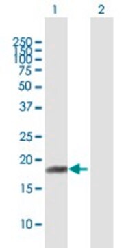 Anti-RPP21 antibody produced in mouse purified immunoglobulin, buffered aqueous solution