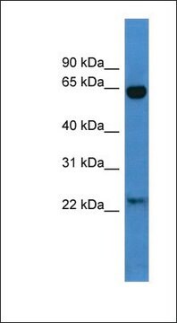 Anti-BAIAP2 antibody produced in rabbit affinity isolated antibody