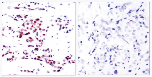 Anti-STAT5A antibody produced in rabbit affinity isolated antibody