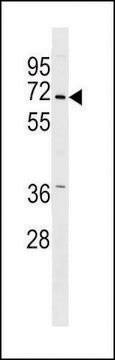 ANTI-PINK1 (PARK6) (CENTER) antibody produced in rabbit purified immunoglobulin, buffered aqueous solution